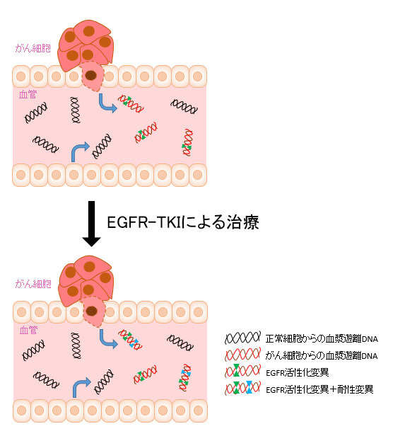 EGFR-TKIによる治療